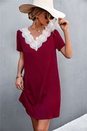 Chic Lace Women's Dress with Casual Design