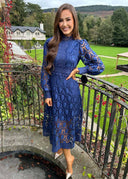Chic Lace Dress for Effortless Style